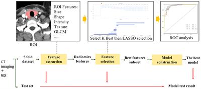 Value of Whole-Thyroid CT-Based Radiomics in Predicting Benign and Malignant Thyroid Nodules